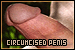 Penis: Circumsized